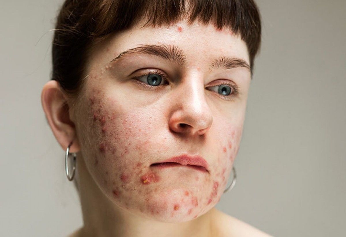 1200_15293349551200_1529312557Sophie-Harris-Taylor_Epidermis_photography_itsnicethat_ANNIE