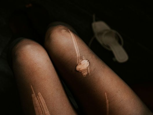  Kateryna Hliznitsova