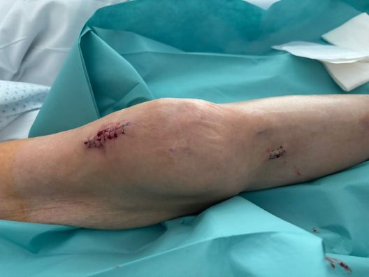 WhatsApp Image 2026 04 03 at 09.03.29